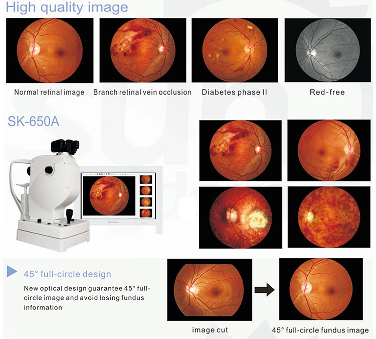 SK-650A Fundus Camera