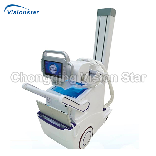 XMX32Y Mobile Digital Radiography System