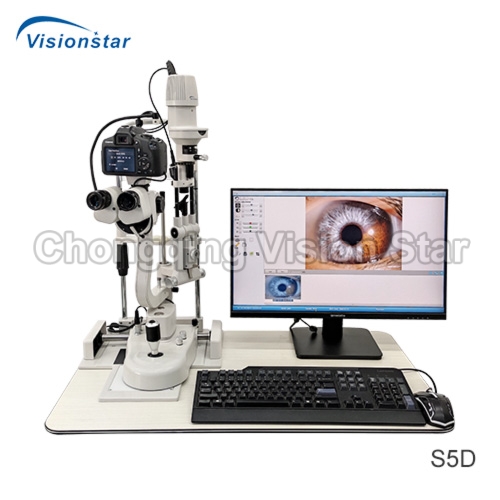 S5D Digital Slit Lamp