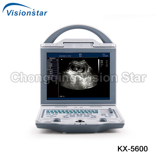 KX-5600 B/W Ultrasound Machine