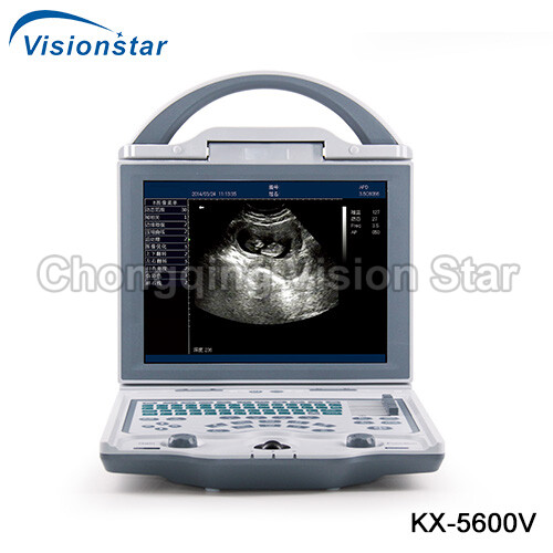 KX-5600V B Mode Veterinary Ultrasound Scanner