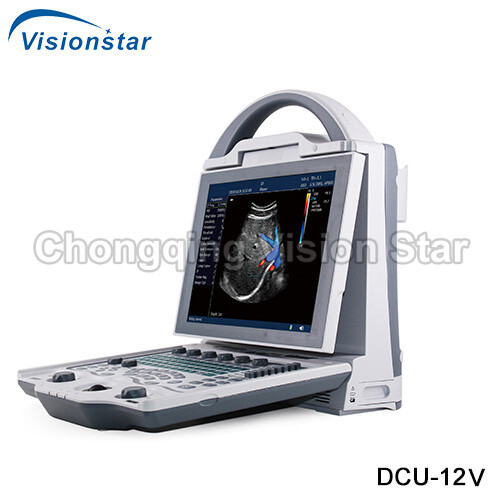 DCU-12V Veterinary Color Doppler Ultrasound Machine