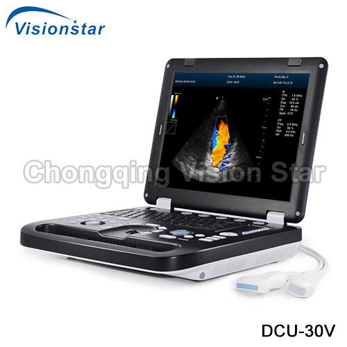 DCU-30V Portable Veterinary Ultrasound Machine