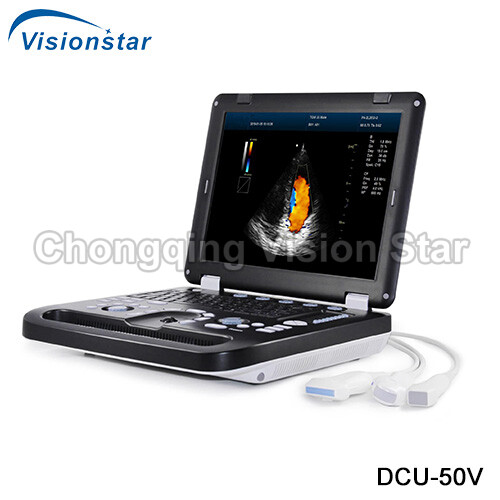 DCU-50V Color Veterinary Ultrasound Machine