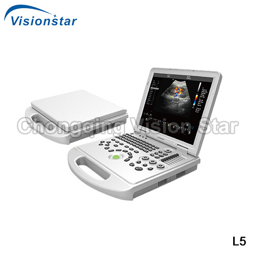 L5 Laptop 4D Color Doppler Portable Ultrasound Scanner