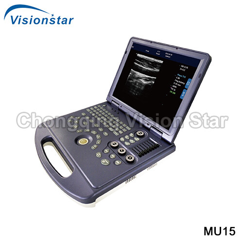 MU15 Windows System Full-digital Black and White Ultrasound 