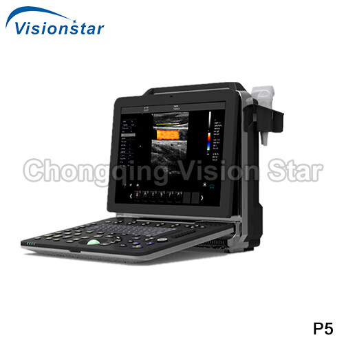 P5 Laptop 4D Color Doppler Portable Ultrasound Scanner