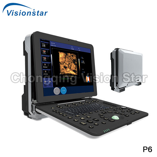 P6 4D Color Doppler Portable Ultrasound Machine