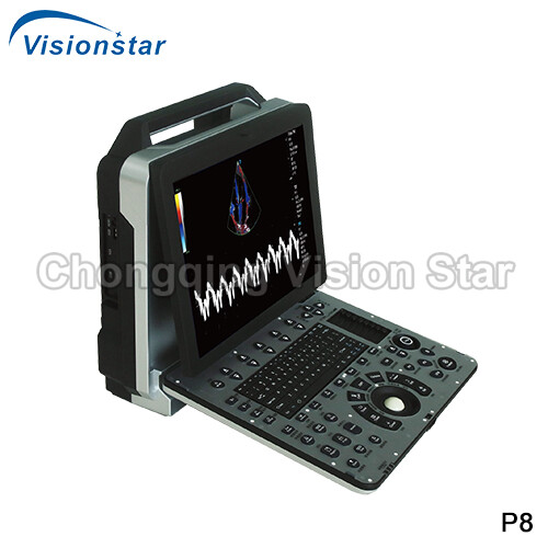 P8 4D Echo Color Doppler Trolley Type Ultrasound Machine