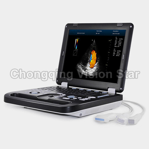 Ultrasound Machine