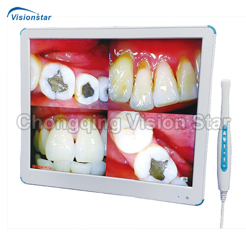 YSD-880/YSD-880S Intraoral Camera