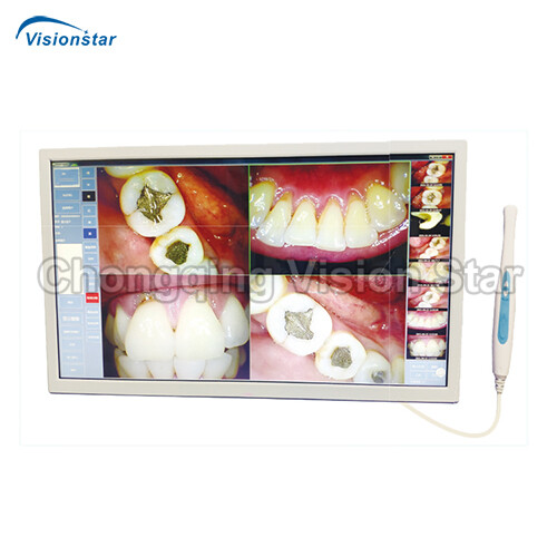 YSD-960 Intraoral Camera