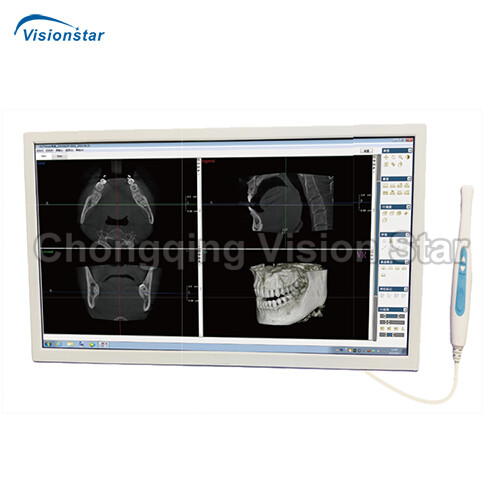 YSD-960H Intraoral Camera