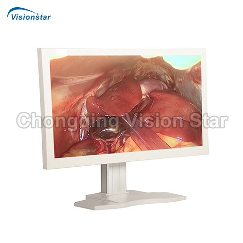 Endoscopy Monitor