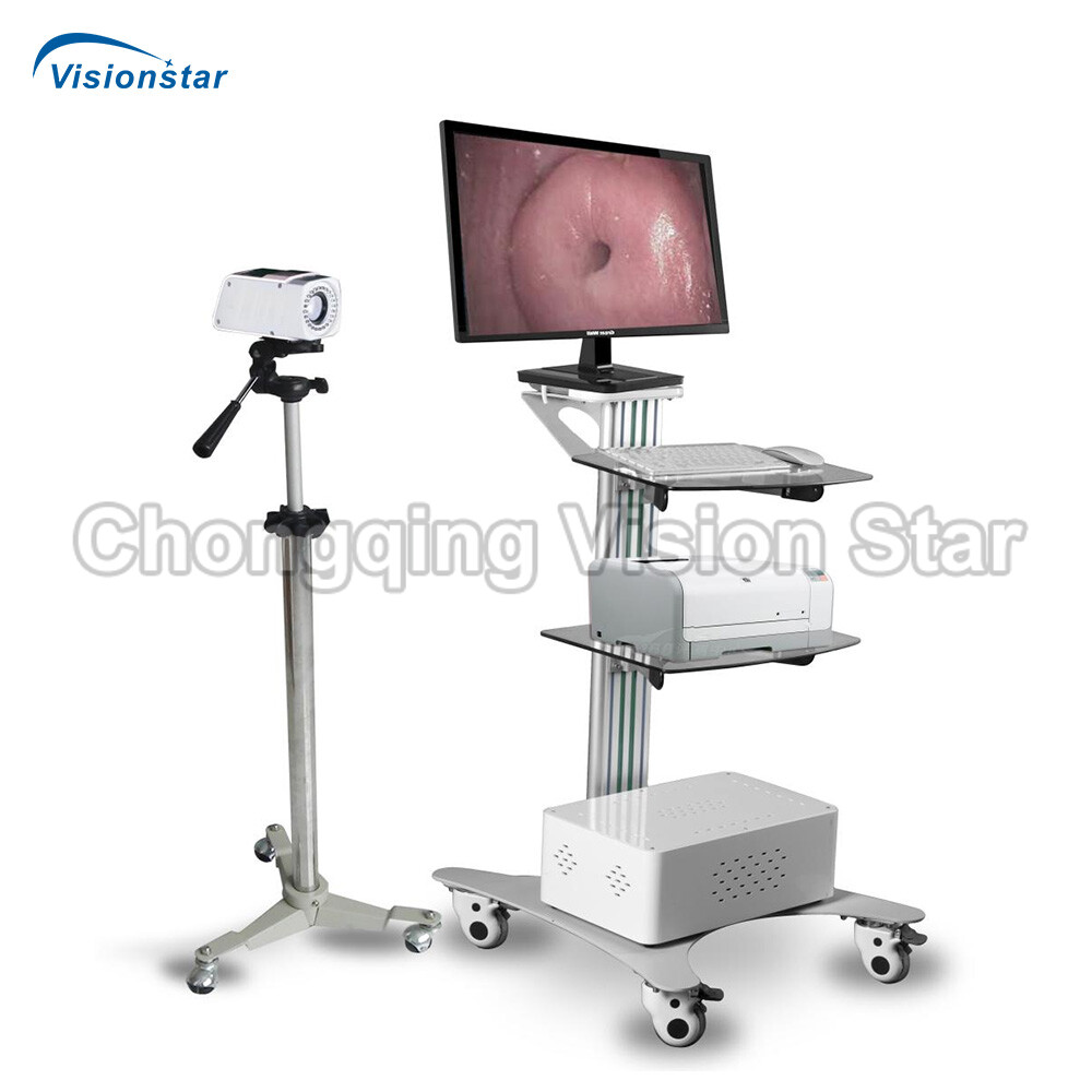 OCP3302 Digital Video Colposcope