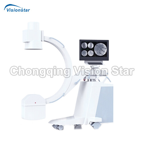 XCR116A1 High Frequency Mobile C-arm System