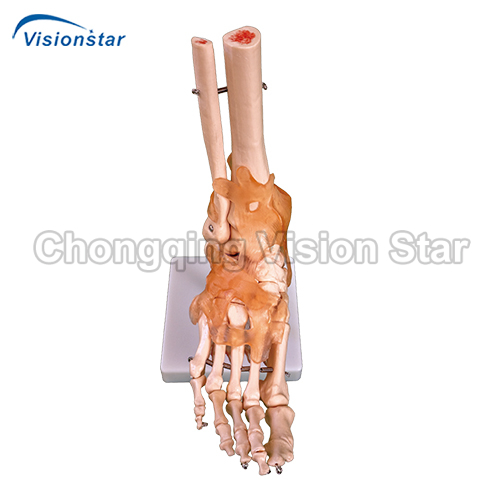 AJM113A Life-Size Foot Joint with Ligaments