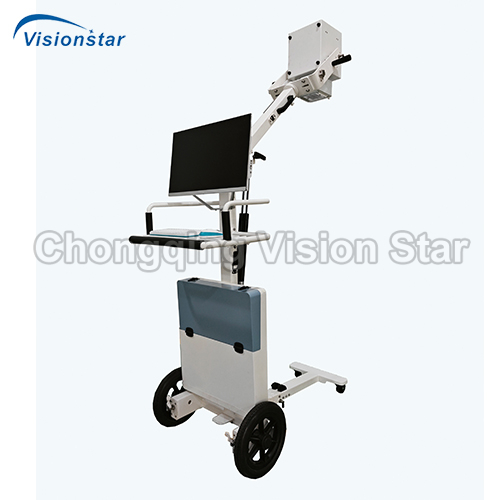 XMX5KW Mobile Digital Radiography System