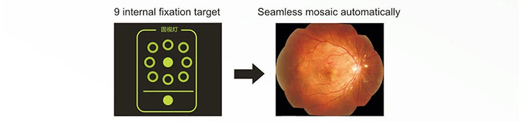 SK-650A Fundus Camera